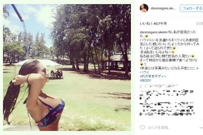 ダレノガレ明美が豊胸