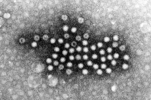 ノロウイルス顕微鏡写真