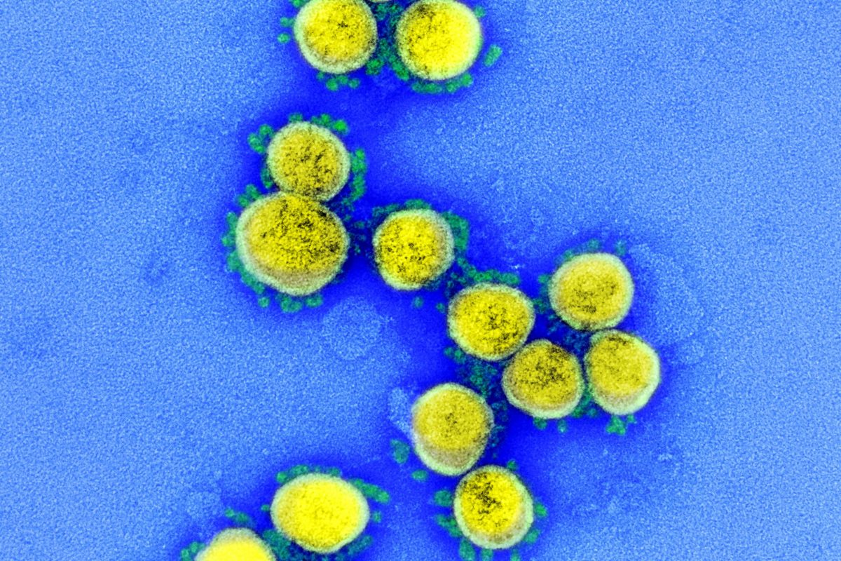 新型コロナウイルス・COVID-19・SARS-CoV-2