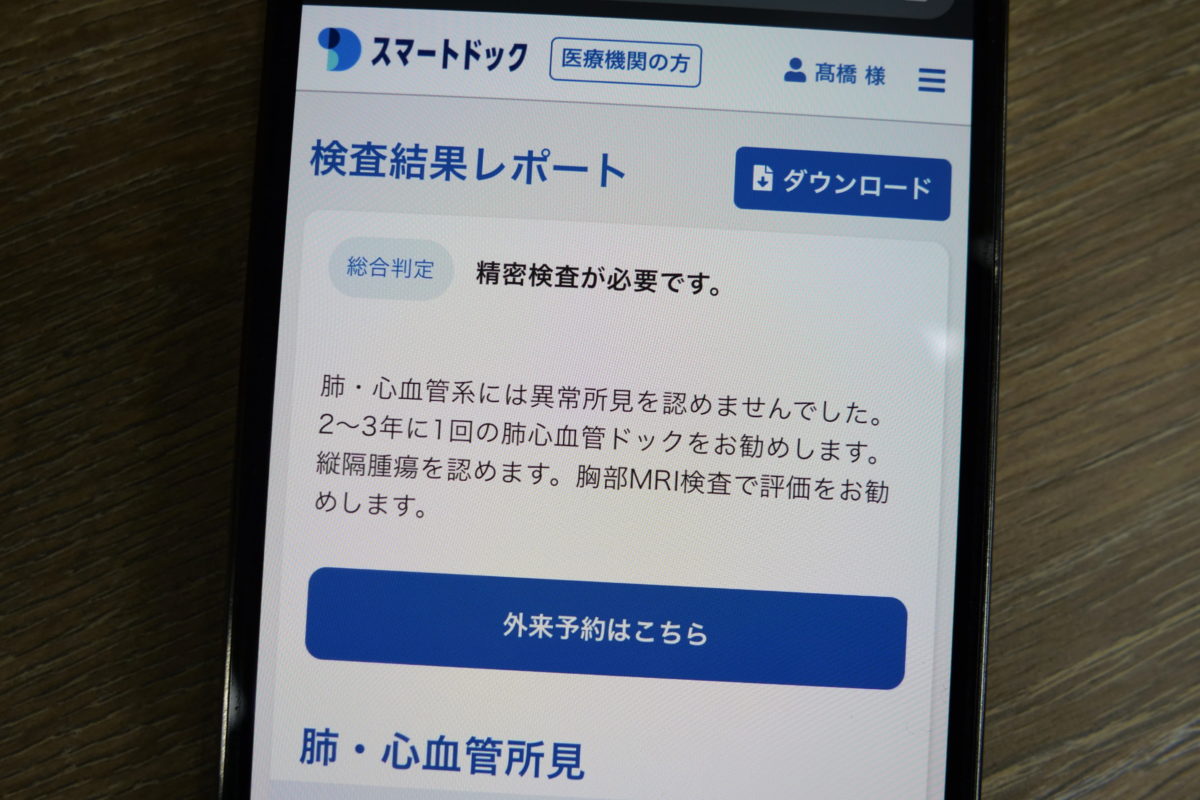 スマート脳ドック