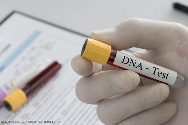 DNA・検査