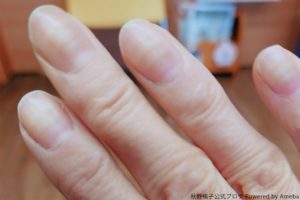秋野暢子、抗がん剤の影響で爪にある変化が…　「戦利品でしょうか」
