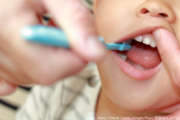 歯磨き・子供・歯磨き嫌い・歯医者