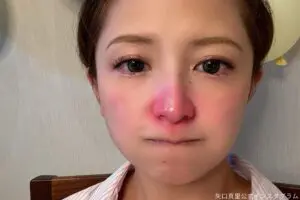 矢口真里、鼻が“真っ赤”になり大焦り　「そんな大変なことに…」