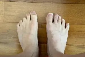 下半身麻痺になった佐藤弘道、“24時間痺れ”足の指を公開　「これでは身体を支えられない」