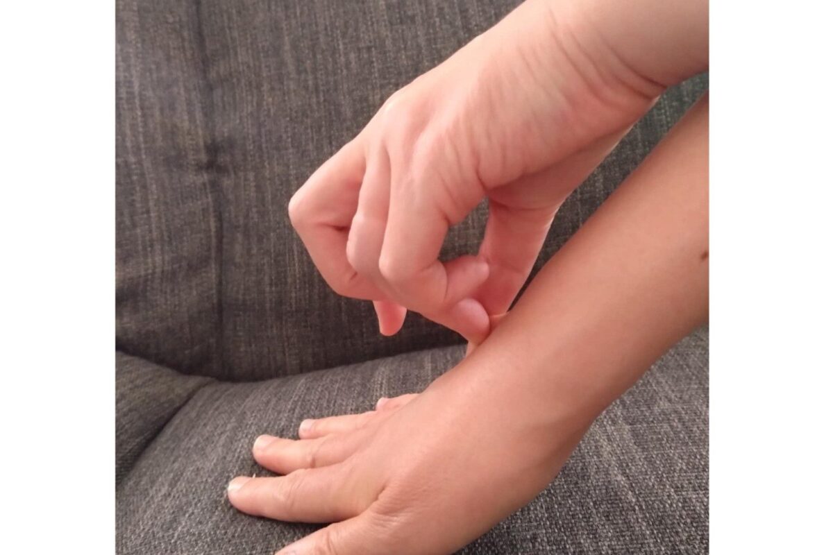 熱中症