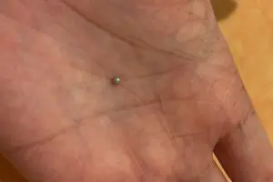 サイゼリヤのムール貝、中から真珠発見され話題 「どれくらいの確率?」真珠のプロに聞いた