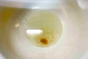 sirabee20251228radish6