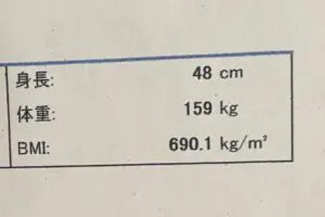 身長48cmの女性コスプレイヤー、健康診断の結果が「異次元すぎる」と話題 BMIは前人未到の690